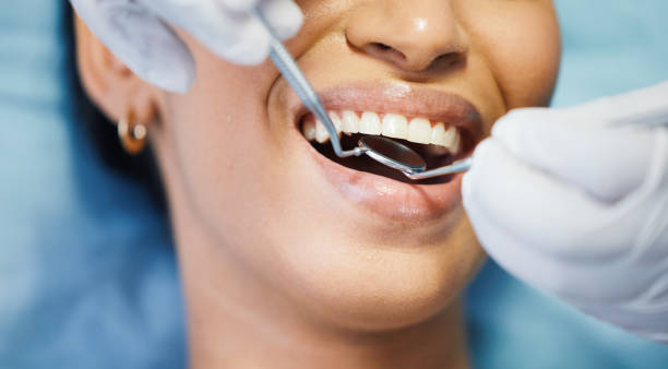 Best Emergency Denture Repair in Toronto, OH